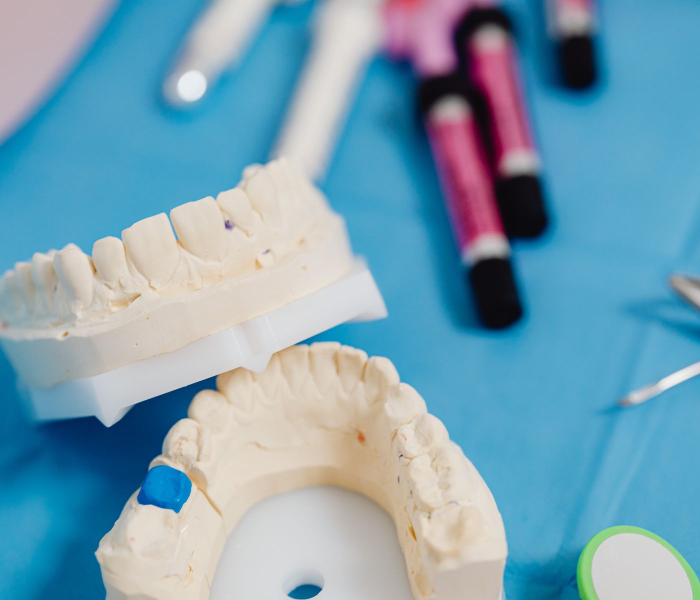 Dental models used to discuss smile options